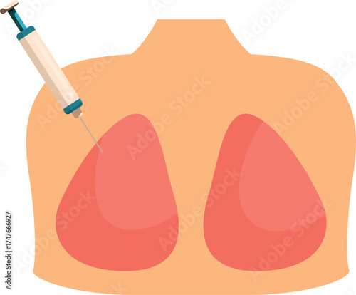 Syringe injecting vaccine into lungs, promoting respiratory health and preventing pneumonia