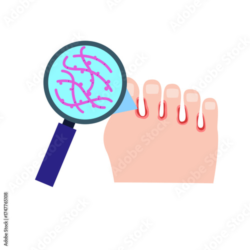 Athlete's Foot disease concept