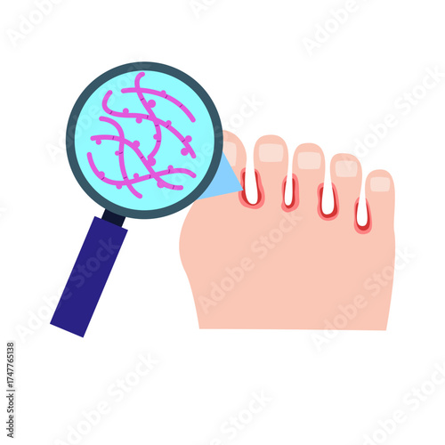 Athlete's Foot disease concept