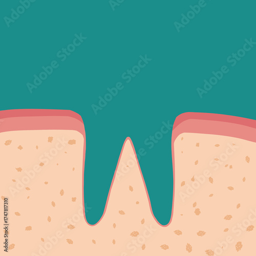 치과 치아치료 tooth treatment