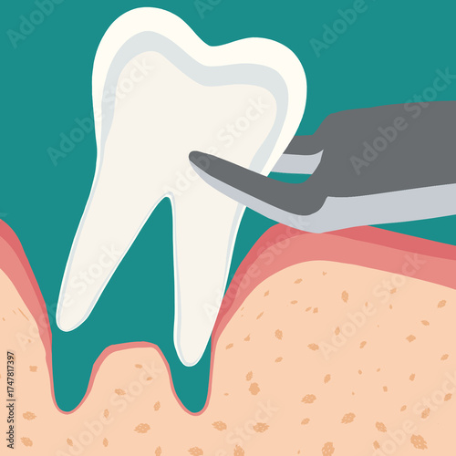 치과 치아치료 tooth treatment
