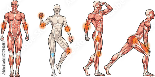 Human anatomy illustration showing muscle pain and joint injury points, educational medical vector art for anatomy study, health, and physiology learning.