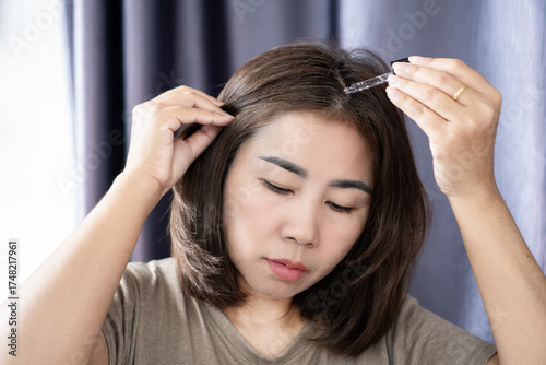 Asian woman applying serum on head to treat bald spots, hair loss, and dry scalp. Concept of hair care, scalp treatment, beauty routine, hair growth therapy, thinning hair, dandruff ,damaged scalp