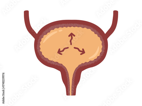 Bladder Incontinence Overflow
