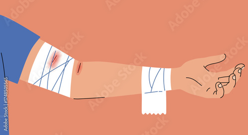 Wound Care and Bandaging Medical Illustration of Arm Injury and First Aid on Colored Background