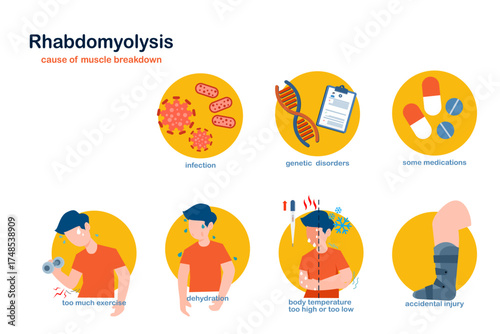 Flat medical illustration of health care concept. Rhabdomyolysis. Infographic on causes of rhabdomyolysis