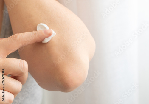Cream on elbow skin. Applying the lotion to dry rough hands skin, elbow moisturizing creme