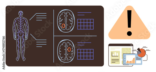 Human body anatomy and brain scans annotated with medical data, triangular alert, and chart display. Ideal for healthcare, radiology, diagnostics, warning, information systems, analysis