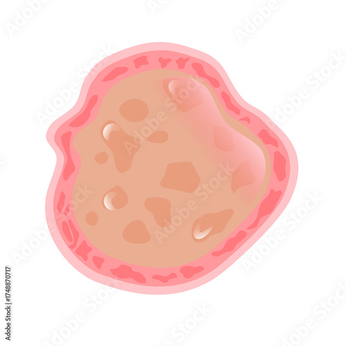 Dermatophytosis Illustration, a digital anatomical asset showcasing the body's fundamental building blocks for biology education and medical visualizations