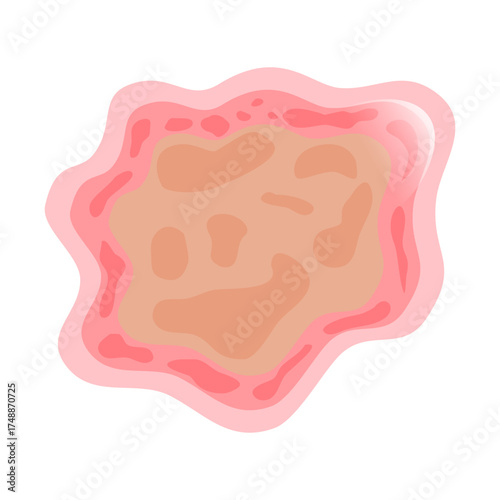 Dermatophytosis Illustration, a digital anatomical asset showcasing the body's fundamental building blocks for biology education and medical visualizations