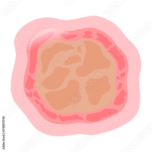 Dermatophytosis Illustration, a digital anatomical asset showcasing the body's fundamental building blocks for biology education and medical visualizations