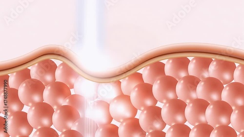 Laser shot through Saggy skin cell layer, skin and Facial treatment. 3D animation.
