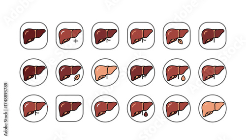 Liver icon vector set collection. Human organ anatomy illustration. Medical healthcare symbol. Hepatitis, cirrhosis, fatty liver disease. Healthy and unhealthy concept for diagnosis.