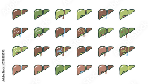 Liver disease icon set. Medical vector illustration of healthy and sick human organ. Concepts for cirrhosis, hepatitis, fatty liver, cancer. Anatomy for hepatology and healthcare.