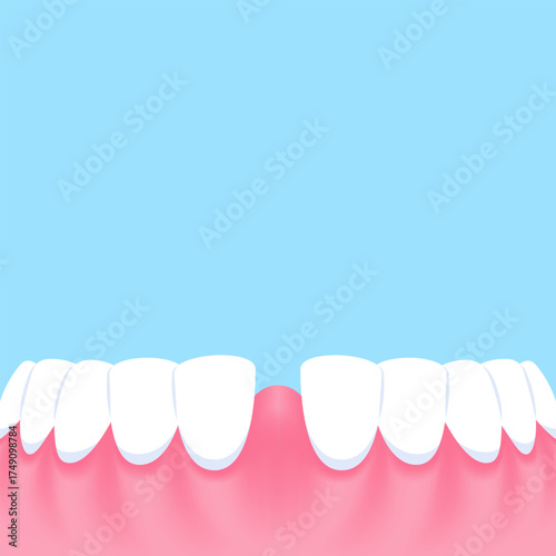 Lower teeth (Diastema) - Text box sign blank banner (square) illustration vector design. Dental care concept.
