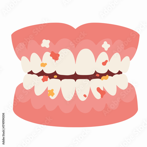 Teeth and Gum Health A Visual Depiction of Plaque and Tartar Buildup within the Mouth