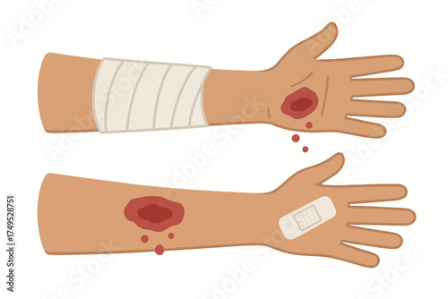 Illustration of arm wounds with bandage and blood drops on two arms