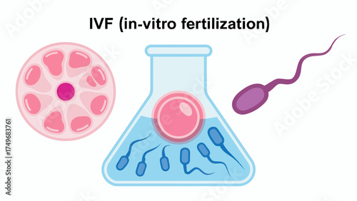 In Vitro Fertilization IVF Concept Showing Egg Sperm and Laboratory Beaker for Reproductive Health Awareness and Family Planning