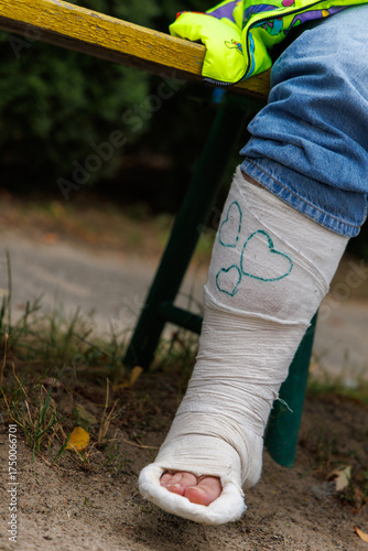 leg in a cast painted with hearts