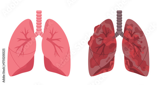 Compare healthy lungs with lungs damaged by smoking, perfect for medical education or anti-smoking campaigns, detailed illustration of respiratory health