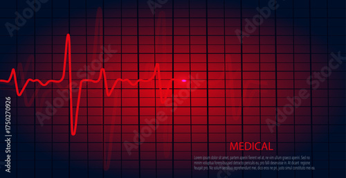 Cardiology concept with pulse rate diagram. Medical background with heart cardiogram.