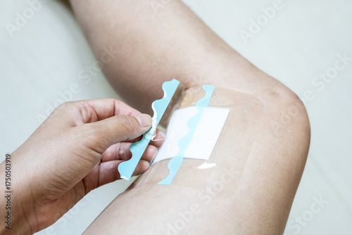 Apply sterile transparent dressing to postoperative suture wounds