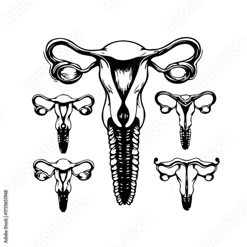 Stylized uterus illustration demonstrating anatomical variations and reproductive health