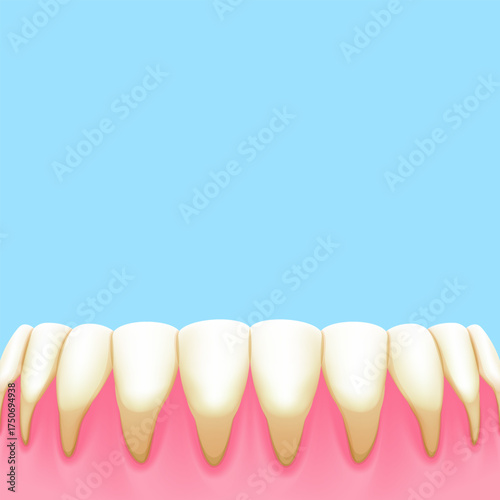 Lower teeth (Recession gums) - Text box sign blank banner (square) illustration vector design. Dental care concept.