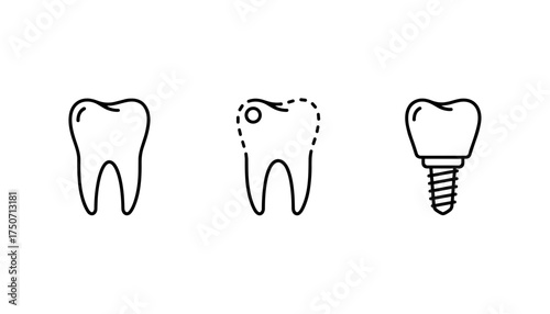 Tooth stages vector icon set. Healthy tooth, tooth decay with cavity, and dental implant. Thin line icons for dentistry, oral health, dental care, restoration, surgery concept.