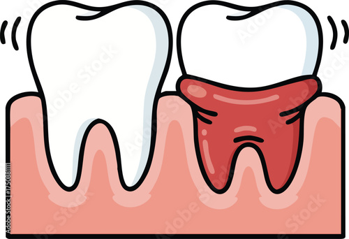 vector illustration of teeth and gums