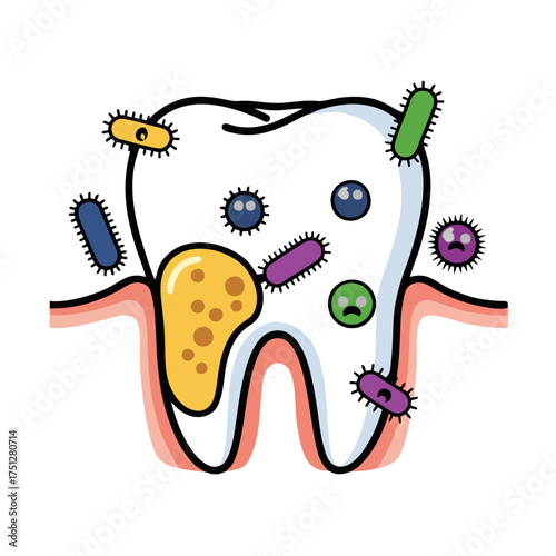 Cartoon illustration of a healthy tooth with various colorful bacteria and a cavity.