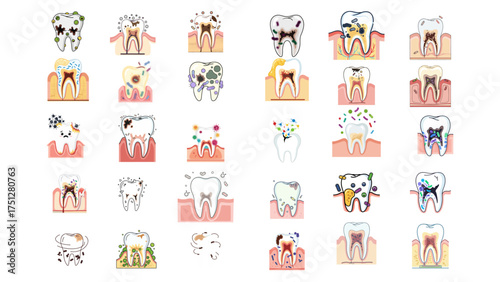 Collection of Illustrated Human Teeth Showing Various Dental Conditions and Treatments.