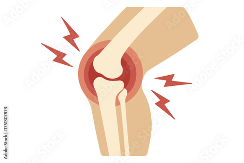Illustration of knee pain with lightning symbols highlighting joint discomfort