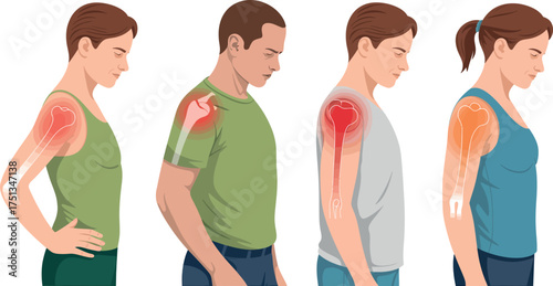 Illustration showing shoulder pain and injury in different poses isolated on white background