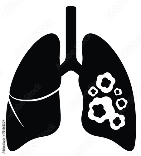 Lung cancer medical illustration for healthcare concept
