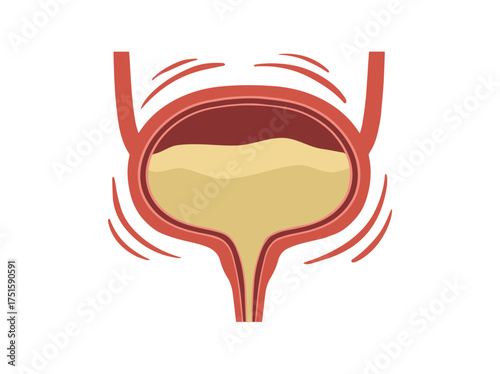 Bladder Urge Incontinence Clip Art Illustration