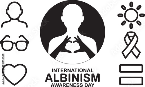 International Albinism Awareness Day: Global support for individuals living with albinism