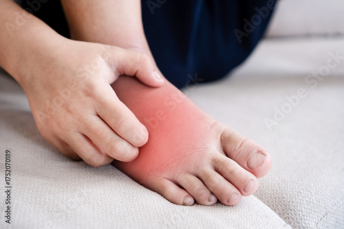 Asian boy scratching his feet with redness and itching caused by kin itching hand scratching allergic. Close-up view of a child’s leg showing skin rash, swelling, and allergic reaction to insect.