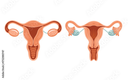 Anatomical illustration of female reproductive system uterus ovaries fallopian tubes