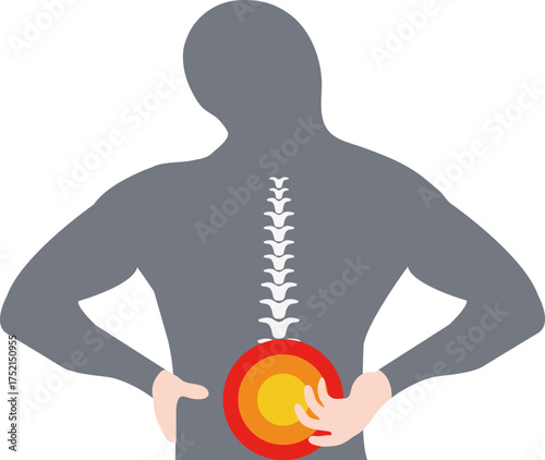 arthralgia