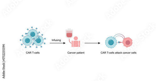 CAR T-cell therapy, killing of tumor cells. Cancer therapy. Chimeric antigen receptor T cell ,CAR T cell, for use in immunotherapy. Genetic engineering. Chemotherapy. Vector illustration.