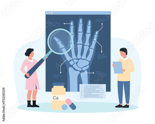 Diagnosis of osteoarthritis, rheumatoid arthritis using radiography vector illustration. Cartoon tiny people holding magnifying glass to examine xray of human wrist bones on medical exam in hospital