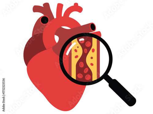 Magnifying glass reveals clogged artery within a human heart illustration