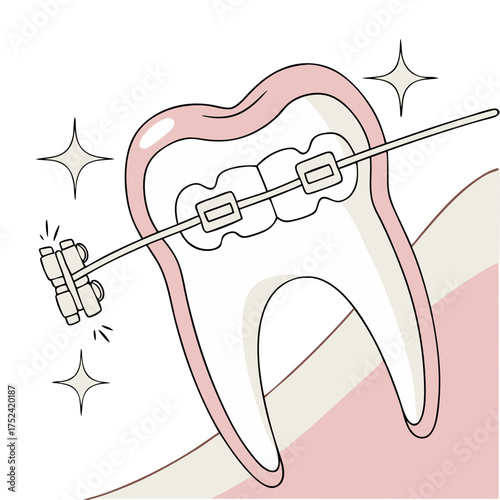 Tooth with braces shining, bright illustration highlighting orthodontic care and teeth straightening