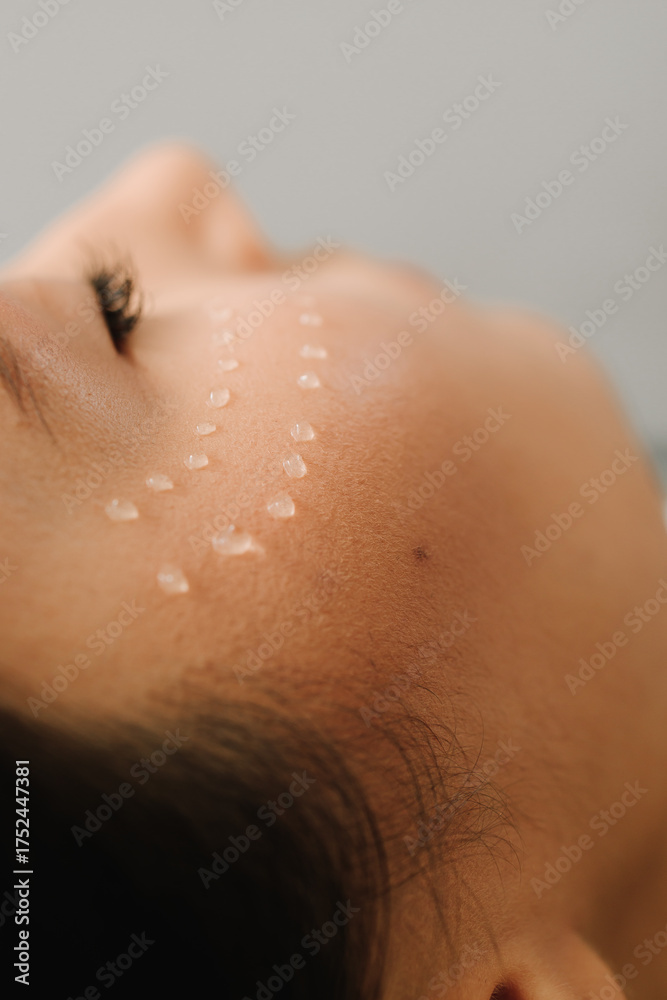 Fototapeta premium Cosmetologist is making facial mesotherapy injections for girl. Facial mesotherapy to rejuvenate skin and improve skin health and appearance.