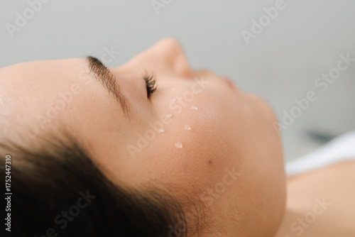 Canvas Print Biorevitalization injections to enhance skin firmness and moisture balance