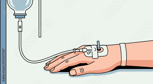 Intravenous Drip Illustration - Medical Treatment and Healthcare Concept.