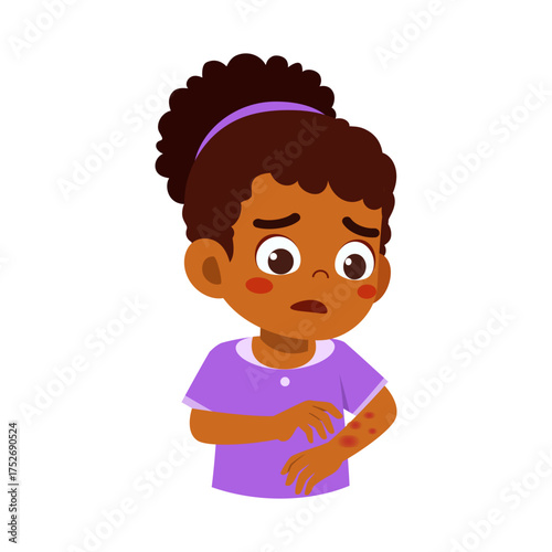 Worried African Girl with Itchy Rash on Arm Dermatology Skin Problems in Cartoon Illustration