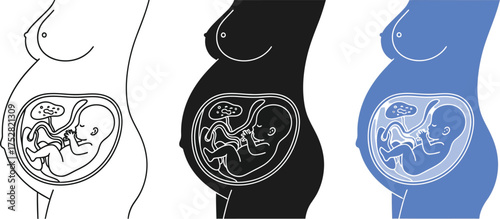 Illustration of a pregnant woman's silhouette showing a fetus developing inside the womb