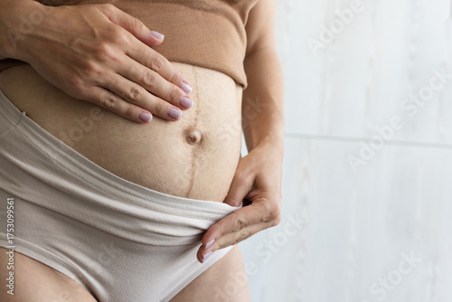 Woman in underwear showing her body with postpartum flaws. Closeup.